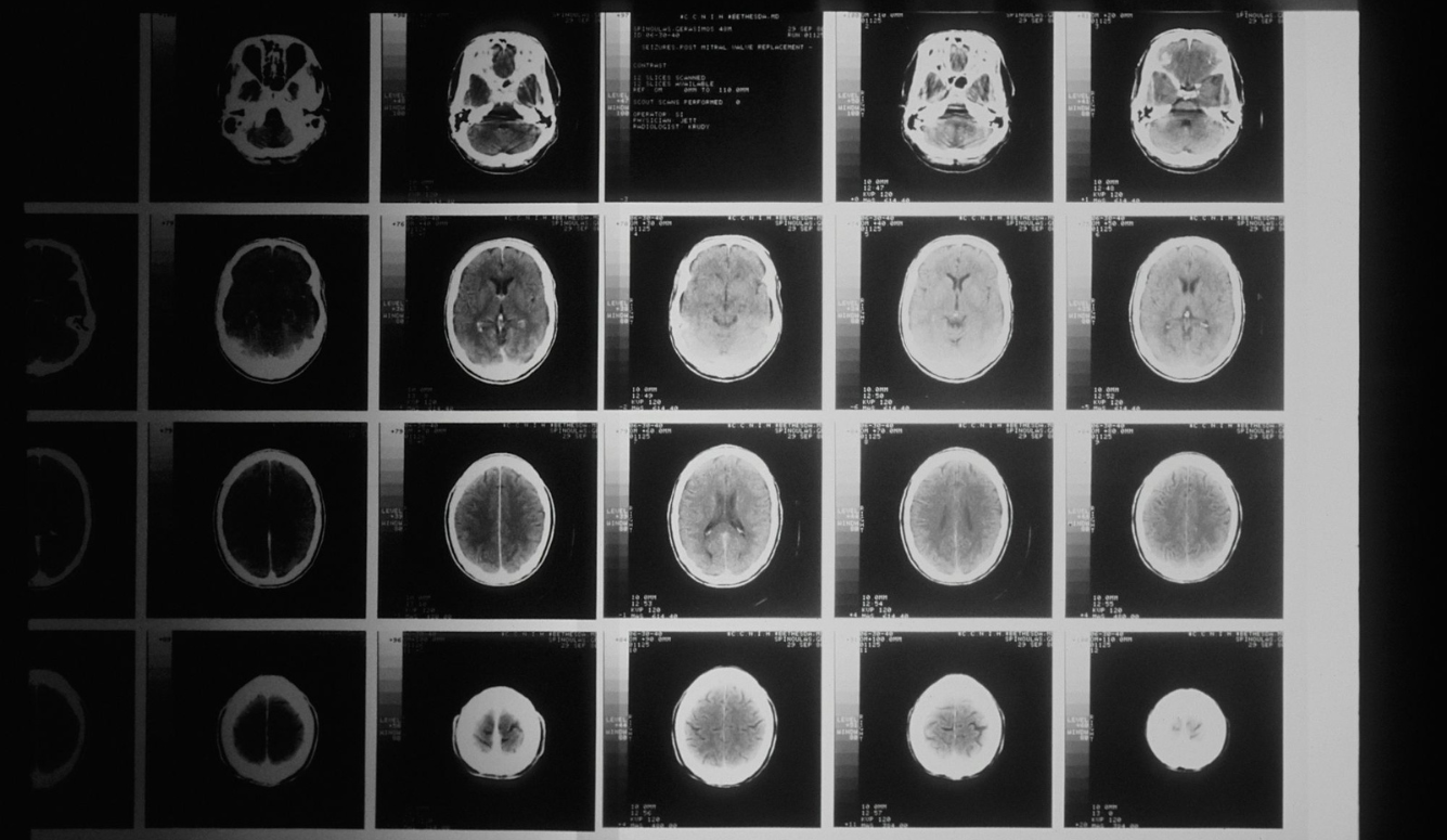 Sex Differences in the Brain and the Mind