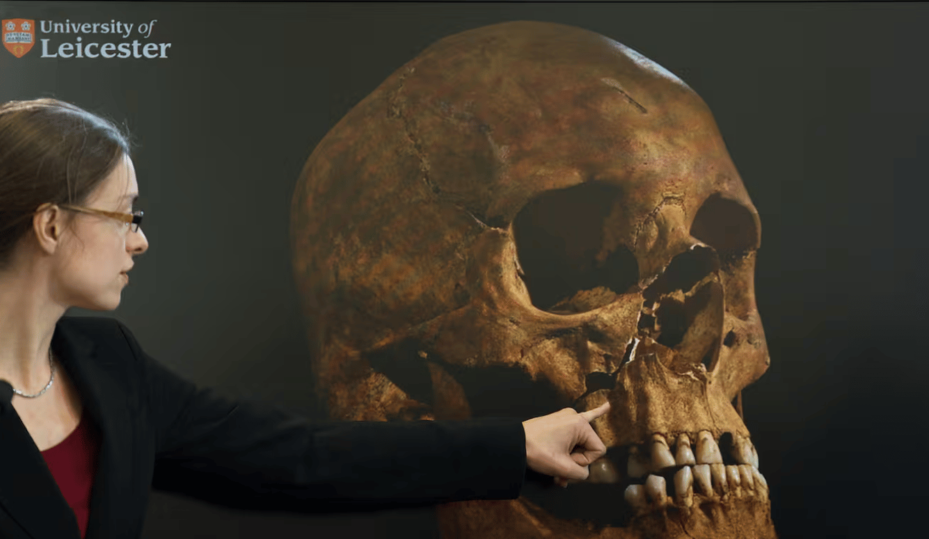 Academic wearing glasses points to the teeth of a large reconstructed human skull beside a University of Leicester logo.