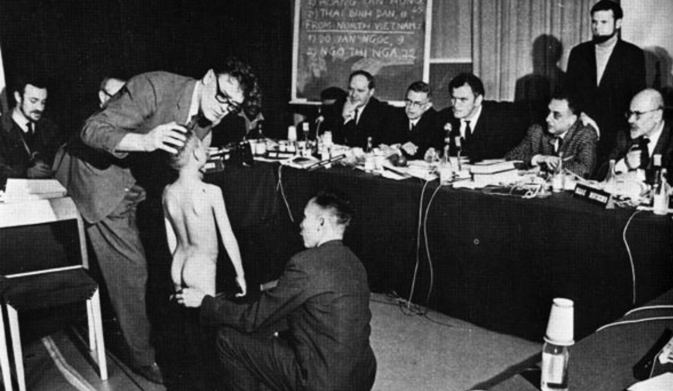 Nine-year-old Do Van Ngoc shows napalm injuries before a tribunal panel in Stockholm, 1976.