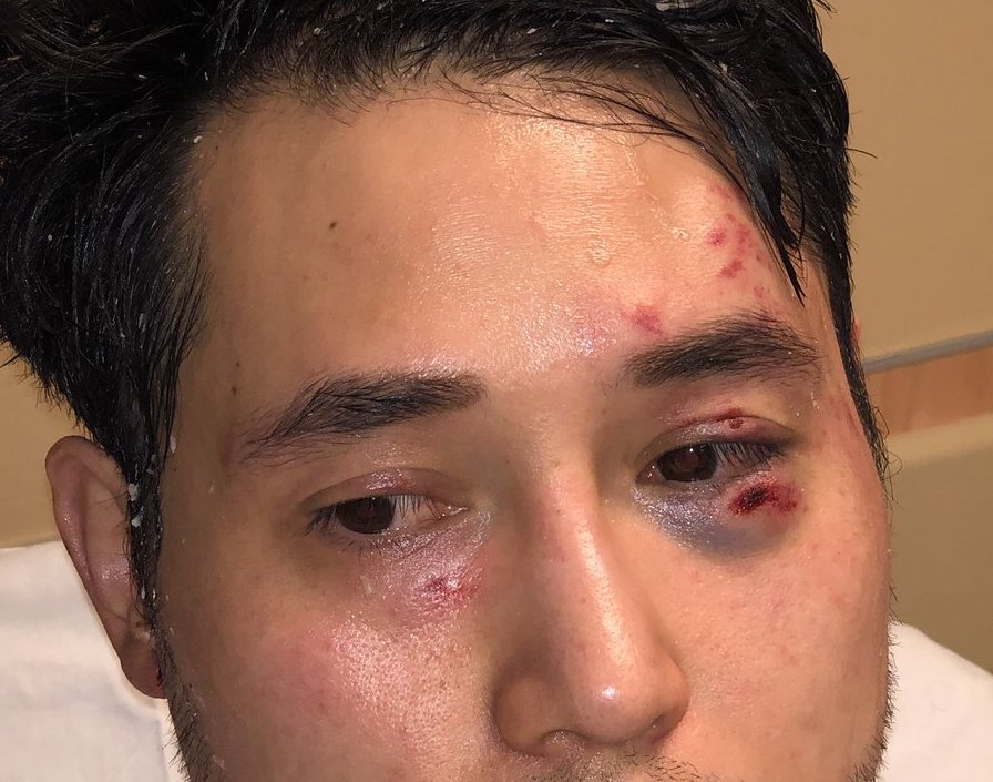 Antifa's Brutal Assault on Andy Ngo Is a Wake-Up Call—for Authorities and Journalists Alike